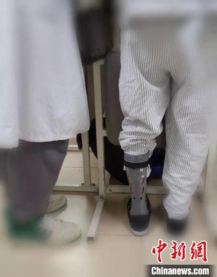 脑中风瘫痪无法站立？粤医生通过3D打印助患者重新走路