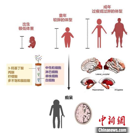 中国学者新发现：保持适当的体重可降低罹患阿尔茨海默病风险